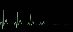 Flatliners